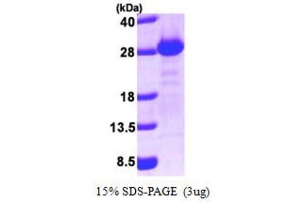 GOPC Protein (AA 278-454) (His tag)