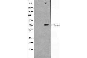 Western blot analysis on HeLa cell lysate using Parkin Antibody. (Parkin anticorps  (Internal Region))