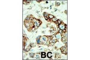 Immunohistochemistry (Paraffin-embedded Sections) (IHC (p)) image for anti-EPH Receptor A2 (EPHA2) (AA 30-60), (N-Term) antibody (ABIN391885)