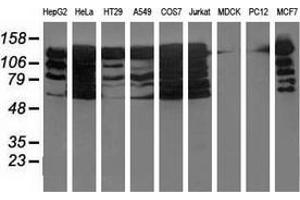 Western blot analysis of extracts (35 µg) from 9 different cell lines by using anti-BUB1B monoclonal antibody. (BUB1B anticorps)