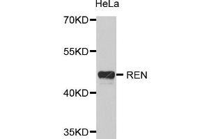 Western Blotting (WB) image for anti-Renin (REN) (AA 24-160) antibody (ABIN6218656) (Renin anticorps  (AA 24-160))