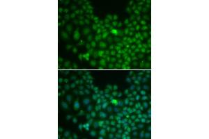 Immunofluorescence analysis of U2OS cells using CLU antibody. (Clusterin anticorps)