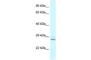 Western Blot showing TPPP antibody used at a concentration of 1 ug/ml against Fetal Liver Lysate (Tppp anticorps  (N-Term))