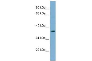 C1ORF75 antibody used at 1 ug/ml to detect target protein. (TMEM206 anticorps  (N-Term))