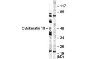 Western blot analysis of extracts from HuvEc cells, using Keratin 18 (Ab-52) Antibody. (Cytokeratin 18 anticorps  (AA 21-70))