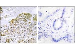 Immunohistochemistry (IHC) image for anti-Transcription Factor EB (TFEB) (AA 10-59) antibody (ABIN2889416) (TFEB anticorps  (AA 10-59))