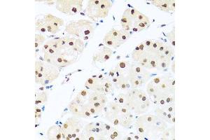 Immunohistochemistry of paraffin-embedded human stomach using RAB3IP antibody. (RAB3IP anticorps  (AA 1-150))