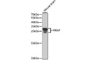 Western blot analysis of extracts of mouse brain, using PRNP antibody. (PRNP anticorps)