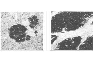Image no. 1 for anti-Enolase 2 (Gamma, Neuronal) (ENO2) antibody (ABIN211314) (ENO2/NSE anticorps)