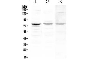 Western blot analysis of PLK2 using anti-PLK2 antibody . (PLK2 anticorps  (AA 94-188))