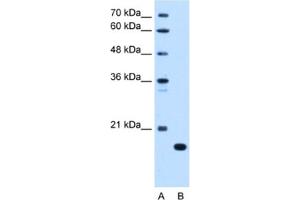 Western Blotting (WB) image for anti-Complement Component 8, beta Polypeptide (C8B) antibody (ABIN2462793) (C8B anticorps)