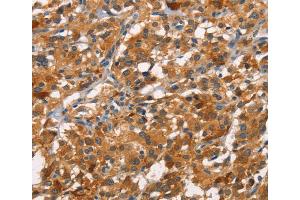 Immunohistochemistry (IHC) image for anti-Cell Division Cycle 25 Homolog B (S. Pombe) (CDC25B) antibody (ABIN2426697) (CDC25B anticorps)
