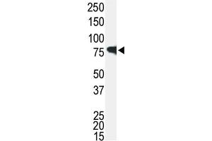 Western blot analysis of IRAK1 Antibody in Jurkat cell lysate. (IRAK1 anticorps)