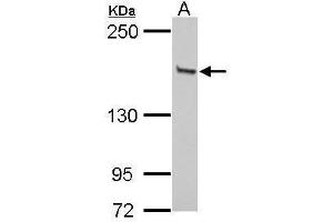 Western Blotting (WB) image for anti-GLI Family Zinc Finger 3 (GLI3) antibody (ABIN2855813)