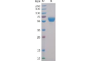 Human 4-1BB Protein, mFc-His Tag on SDS-PAGE under reducing condition. (CD137 Protein (AA 24-186) (mFc-His Tag))