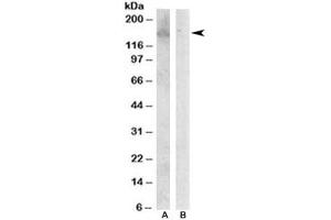 Western blot testing of Jurkat lysate with HER3 antibody at 0. (ERBB3 anticorps)