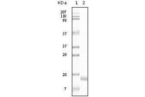 Western Blot showing SNCA antibody used against truncated SNCA recombinant protein. (SNCA anticorps)
