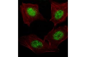 Fluorescent image of A549 cell stained with hARNT-V528. (ARNT anticorps  (AA 513-544))