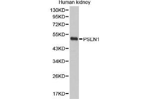 Western Blotting (WB) image for anti-Presenilin 1 (PSEN1) (AA 1-160) antibody (ABIN6219418) (Presenilin 1 anticorps  (AA 1-160))