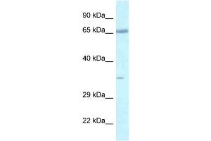 WB Suggested Anti-Lzts1 Antibody   Titration: 1. (LZTS1 anticorps  (C-Term))