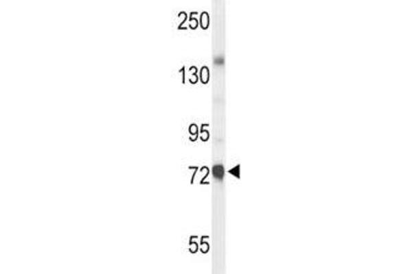 Choline Acetyltransferase anticorps  (AA 98-128)