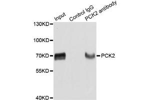 Immunoprecipitation analysis of extracts of HepG2 cells using PCK2 antibody. (PEPCK anticorps)
