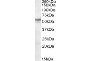 Western Blotting (WB) image for anti-Nicotinic Acetylcholine Receptor beta (CHRNB1) (Internal Region) antibody (ABIN2466671) (CHRNB1 anticorps  (Internal Region))