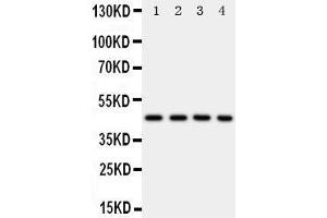 Anti-PDK2 antibody, Western blotting Lane 1: Rat Heart Tissue Lysate Lane 2: HELA Cell Lysate Lane 3: SW620 Cell Lysate Lane 4: MCF-7 Cell Lysate (PDK2 anticorps  (C-Term))