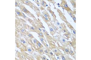 Immunohistochemistry of paraffin-embedded human liver using PPP4R1 antibody. (PPP4R1 anticorps)