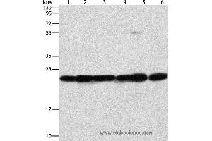 Western blot analysis of Mouse liver and brain tissue, 293T, A549, A431 and PC3 cell, using SIGMAR1 Polyclonal Antibody at dilution of 1:310 (SIGMAR1 anticorps)
