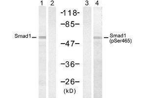 Western blot analysis of extract from 293 cells, untreated or treated with PMA (200nM, 30min), using Smad1 (Ab-465) Antibody (E021321, Lane 1 and 2) and Smad2 (Phospho-Ser465) Antibody (E011321, Lane 3 and 4). (SMAD1 anticorps)