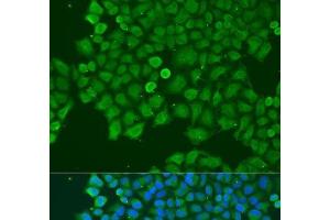 Immunofluorescence analysis of U2OS cells using CAST Polyclonal Antibody at dilution of 1:100. (Calpastatin anticorps)