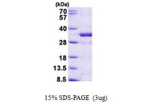 FGF14 Protein (AA 1-247) (His tag)