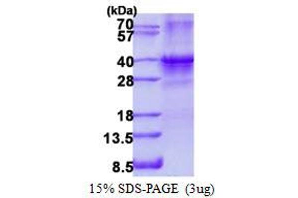 SIX Homeobox 1 Protein (SIX1) (His tag)