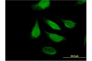 Immunofluorescence of monoclonal antibody to DIS3 on HeLa cell. (DIS3 anticorps  (AA 861-956))