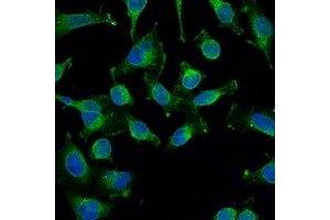 Immunofluorescent analysis of EGFR staining in Hela cells. (EGFR anticorps)