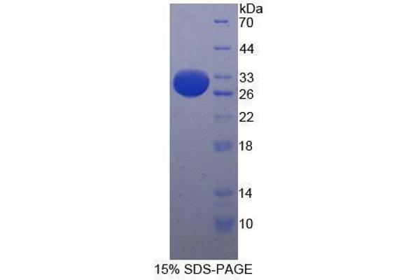 CD103 Protéine