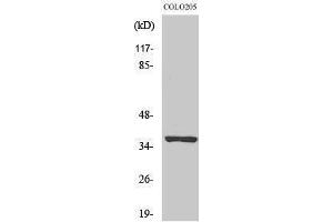 OR52E5 anticorps  (Internal Region)