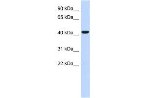 WB Suggested Anti-SGMS2 Antibody Titration: 0. (Sphingomyelin Synthase 2 anticorps  (N-Term))