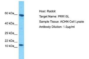 Host: Rabbit Target Name: PRR15L Sample Tissue: Human ACHN Whole Cell Antibody Dilution: 1ug/ml (PRR15L anticorps  (C-Term))