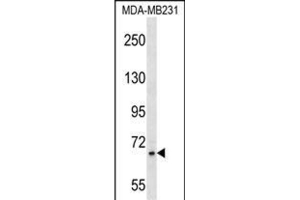 Zinc Finger Protein 44 anticorps  (N-Term)