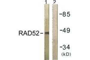 Western blot analysis of extracts from 293 cells, using RAD52 (Ab-104) Antibody. (RAD52 anticorps  (AA 70-119))
