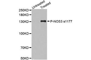 Western blot analysis of extracts of various cell lines, using Phospho-NOS3-S1177 antibody (ABIN2988223). (ENOS anticorps  (pSer1177))