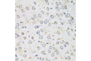 Immunohistochemistry of paraffin-embedded rat brain using Albumin antibody (ABIN3020953, ABIN3020954, ABIN3020955 and ABIN6213817) at dilution of 1:100 (40x lens). (Albumin anticorps  (AA 20-255))