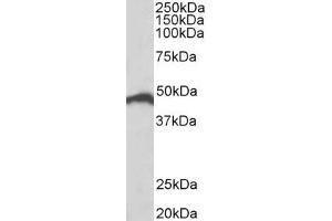 Western Blotting (WB) image for anti-Interferon Regulatory Factor 4 (IRF4) (AA 433-445) antibody (ABIN1102606) (IRF4 anticorps  (AA 433-445))