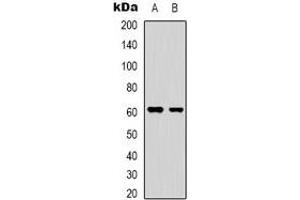 Western blot analysis of YTHDF1 expression in HepG2 (A), HEK293T (B) whole cell lysates. (YTHDF1 anticorps  (N-Term))