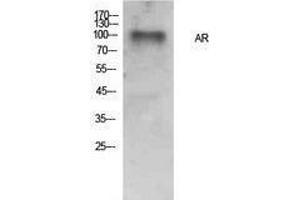 Western Blotting (WB) image for anti-Androgen Receptor (AR) (Internal Region) antibody (ABIN3178884) (Androgen Receptor anticorps  (Internal Region))