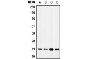 Western blot analysis of MYL7 expression in MCF7 (A), K562 (B), SP2/0 (C), H9C2 (D) whole cell lysates. (MYL7 anticorps  (Center))