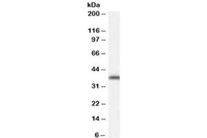 Western blot testing of NIH3T3 cell lysate with ARA9 antibody at 0. (AIP anticorps)