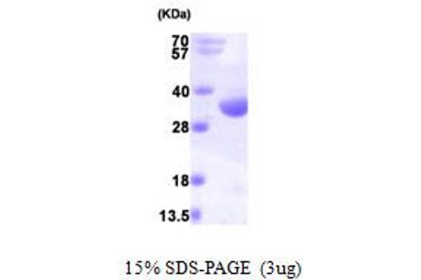 RQCD1 Protein (AA 1-299) (His tag)